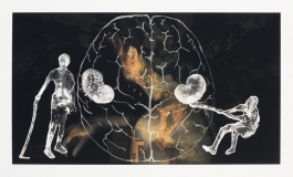 A color photograph depicts a collaged scene of two x-rayed figures on either side of a white outline of a human brain, all is superimposed over a color image of the back of a woman.