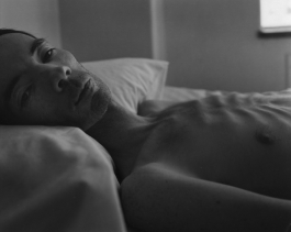 A black-and-white photograph of a very gaunt man lying on his back in bed without a shirt, his ribs protruding, and looking toward the viewer.