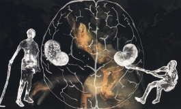 A color photograph depicts a collaged scene of two x-rayed figures on either side of a white outline of a human brain, all is superimposed over a color image of the back of a woman.