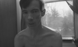 A black-and-white photograph of a gaunt, shirtless, pale-skinned young man sitting in front of a window.
