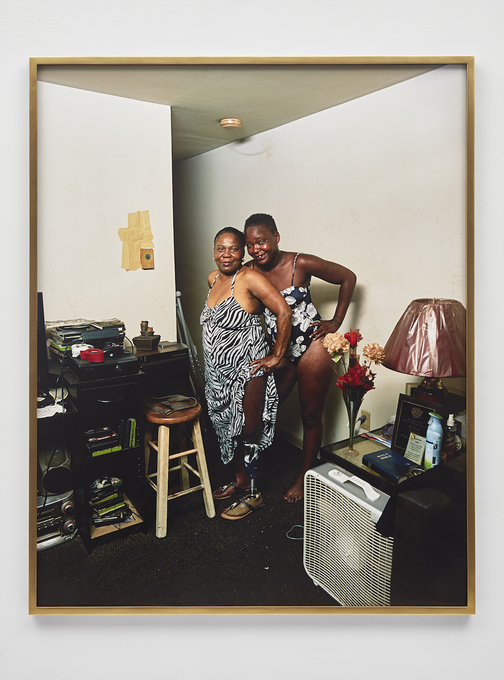A color photograph shows two Black women posing together in cluttered living space. One raises her zebra-print dress to expose a prosthetic leg. The other is in a floral swimsuit. Both have their hair pulled back and smile toward the viewer.