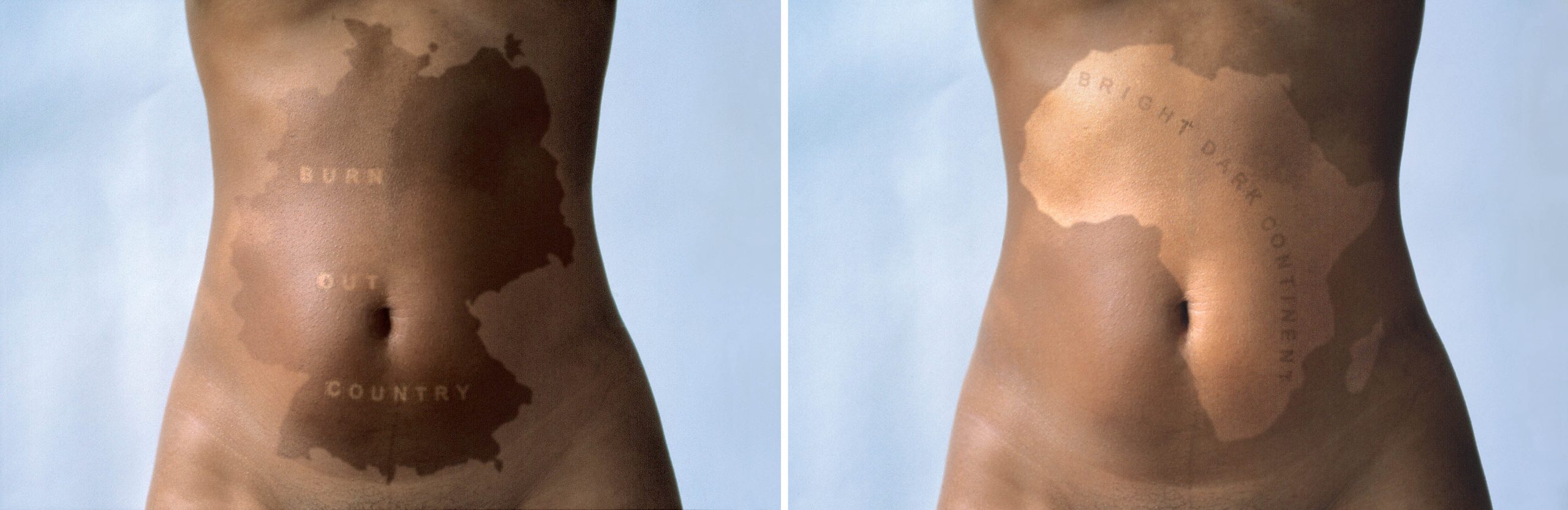Two photos of abdomens with silhouettes of Germany and Africa sunburned on