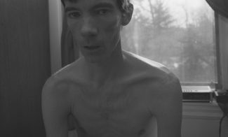 A black-and-white photograph of a gaunt, shirtless, pale-skinned young man sitting in front of a window.