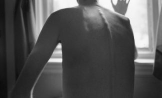 A black-and-white photograph of a pale-skinned figure facing a window. His protruding spine and shoulder blade are clearly visible under his skin.