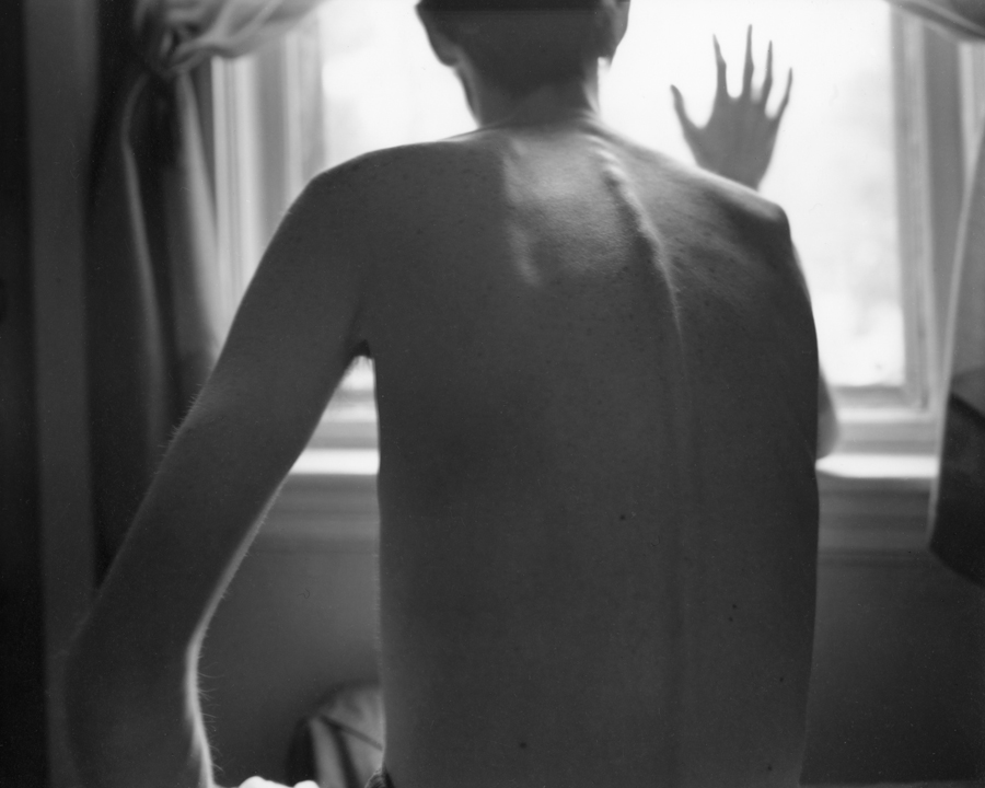 A black-and-white photograph of a pale-skinned figure facing a window. His protruding spine and shoulder blade are clearly visible under his skin.